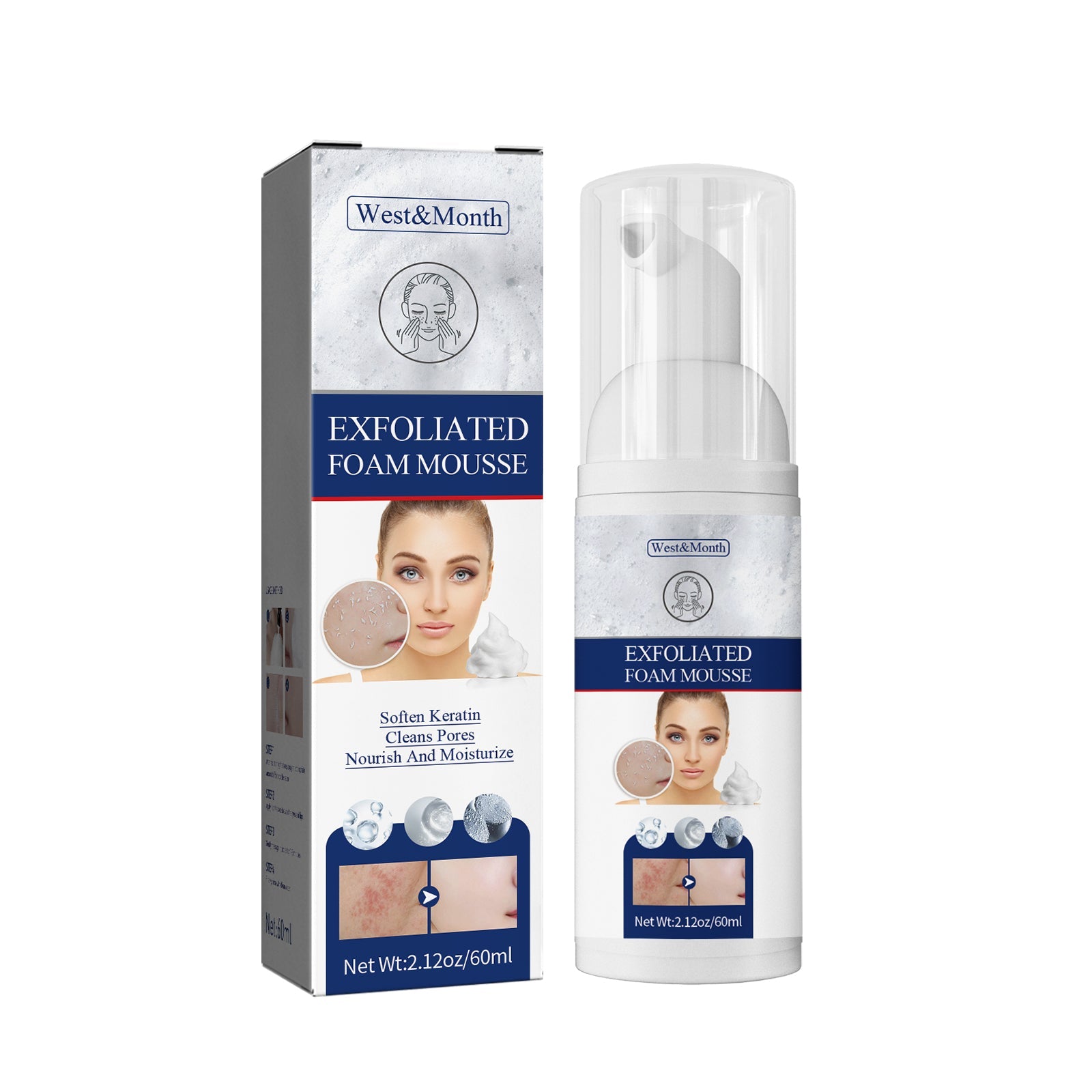 Exfoliating Mousse, Cleanser Skin Pore Control Oil Gently Cleanses Exfoliating Dead Blackheads