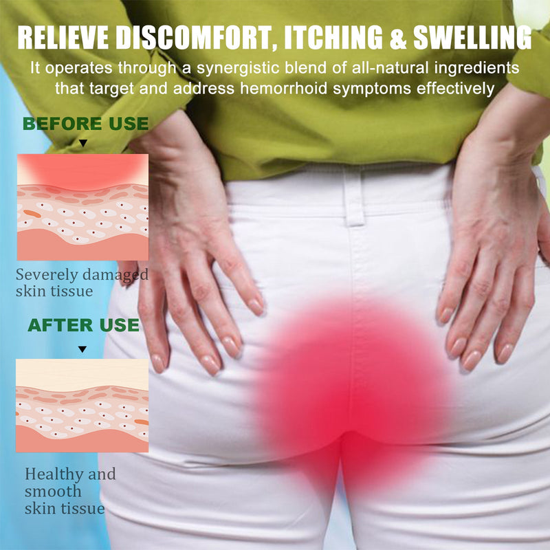 Herbal Hemorrhoids Care Ball, Relieve Perianal Itching Swelling Discomfort Herbal Essence Perianal Gentle Care
