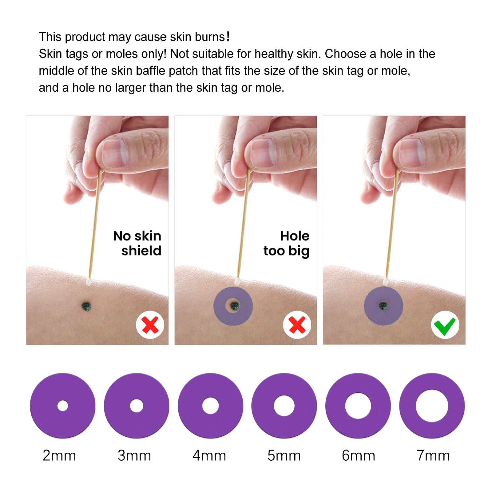 Wart Repair Kit, Skin Tag Remover Hand and Plantar Wart Mole Removal And Repair Lotion Set