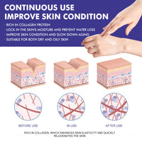 WIYUN Collagen Face Cream, Moisturizing & Firming Skin Collagen Brightening & Curing Skin Cream