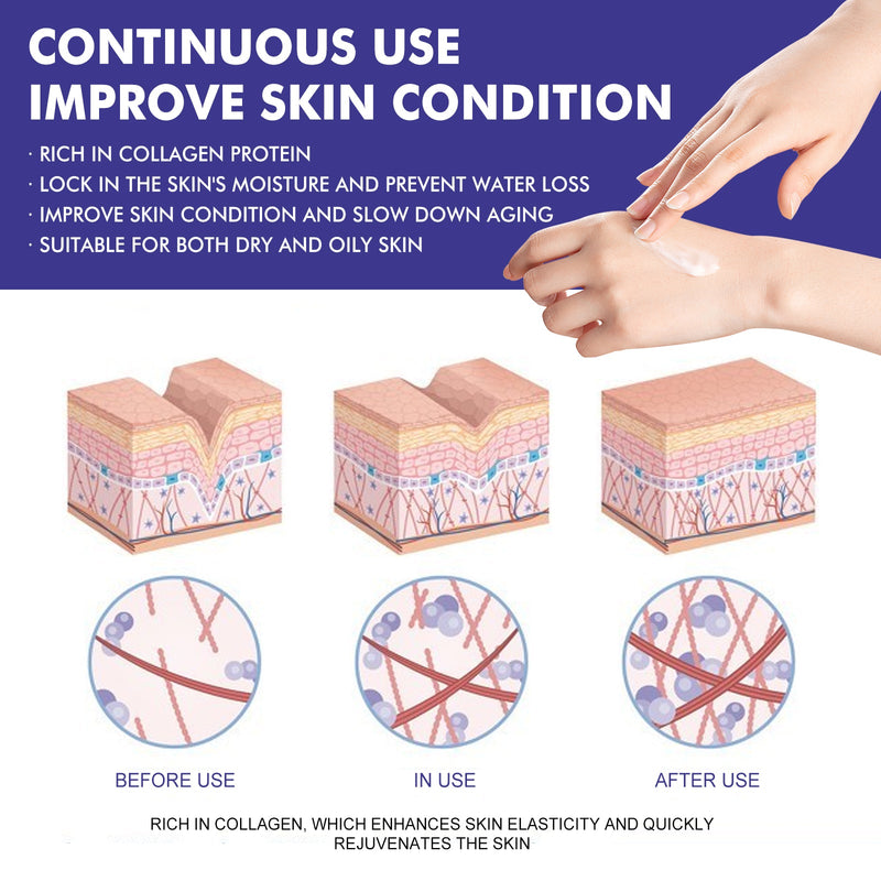 WIYUN Collagen Face Cream, Moisturizing & Firming Skin Collagen Brightening & Curing Skin Cream