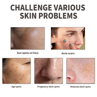 Dark Spot Serum, Fade Spot Moisturize Skin Repair Blain Mark Face Dull Shine Essence
