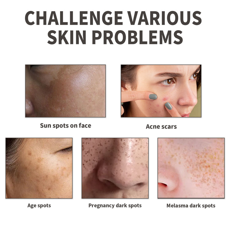 Dark Spot Serum, Fade Spot Moisturize Skin Repair Blain Mark Face Dull Shine Essence