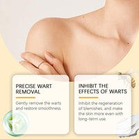 Ximonth Mole Removal Cream, A Gentle Herbal Cleanser And Mole Removal Repair Moisturizing Body Care Cream