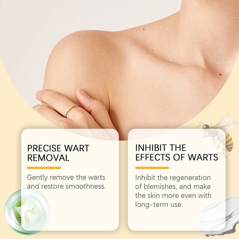 Ximonth Mole Removal Cream, A Gentle Herbal Cleanser And Mole Removal Repair Moisturizing Body Care Cream