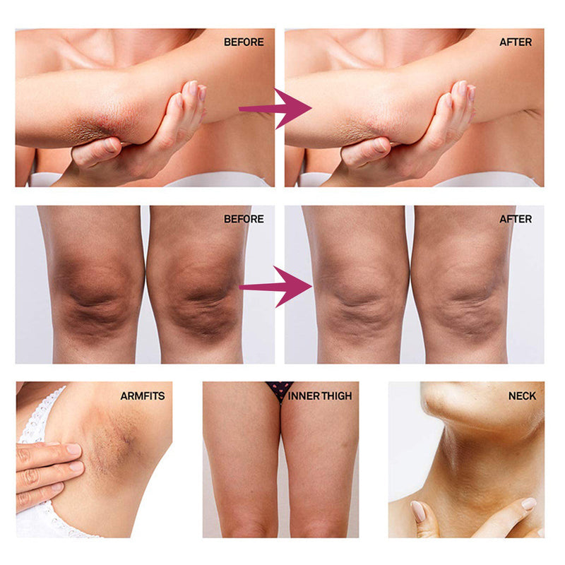 Underarm Whitening Cream Repair Underarm Joints Melanin Moisturizing Skin Whitening Cream