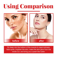 Ouhoe Arbutin Facial Body Essence, Gently Firming And Repairing Skin, Hydrating, Whitening And Anti-Wrinkle