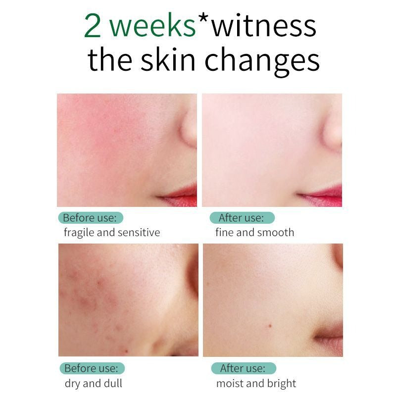 SKIN EVER Centella Repair Face Cream Moisturizing and Moisturizing Repair Facial Skin Face Cream Skin Care Product SK017