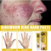 South Moon Skin Care Cream Body Skin Moisturizing Repair Topical Application Ointment Skin Cream