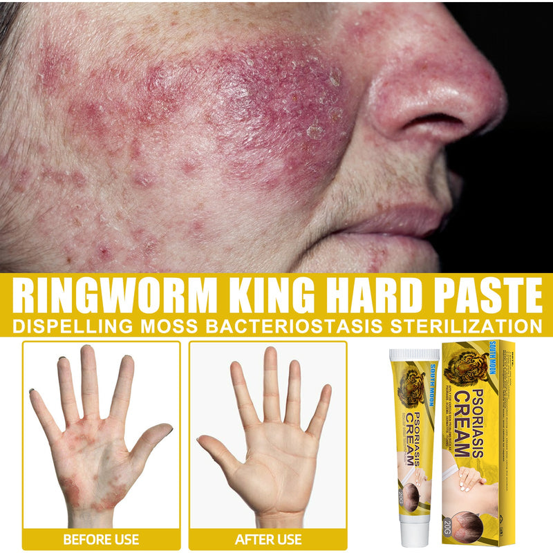 South Moon Skin Care Cream Body Skin Moisturizing Repair Topical Application Ointment Skin Cream