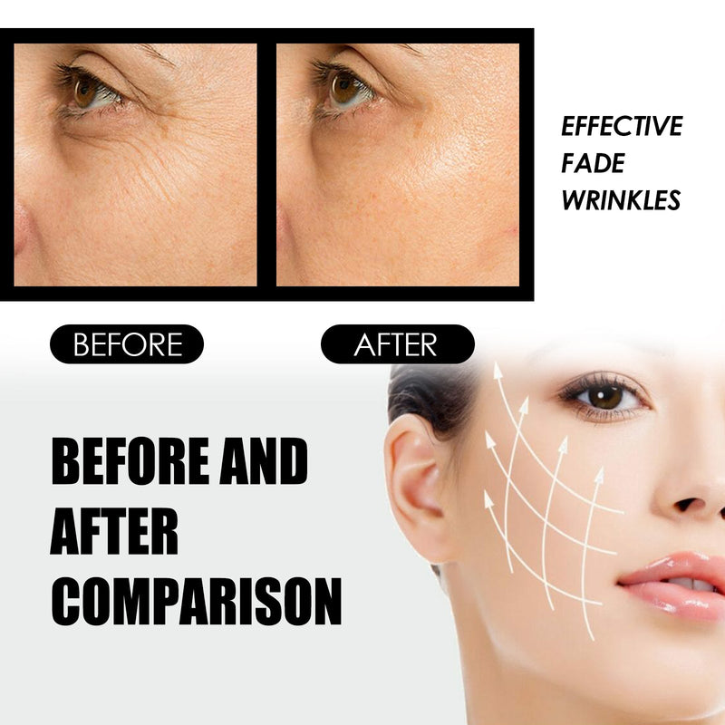Instant Eye Cream Tightener, Moisture To Nourish And Repair Eyes Dark Eyes