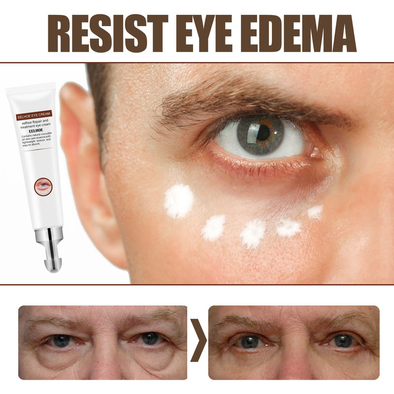 Jojoba Oil Essential Eye Cream, Firming And Lifting Eye Bags To Reduce Dark Circles Repair Eye Cream