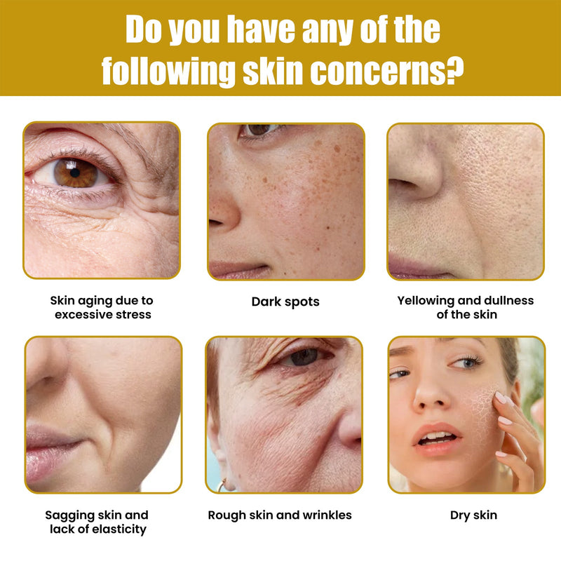 Krema Za Lice S Pčelinjim Otrovom, Fade Out Fine Lines Wrinkles Hydrating Moist Firming Skin Bright Skin Anti-Wrinkle Cream