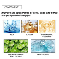 EELHOE Acne Patch Mild Non-Irritating Facial Pores Skin Cleansing Comfort Patch