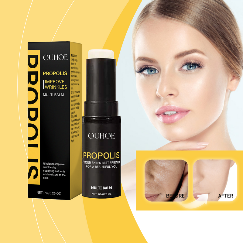 Propolis Eye Moisturizer, Moisturizing And Nourishing The Skin Around The Eyes, Firming, Lifting, Brightening And Anti-Wrinkle Care