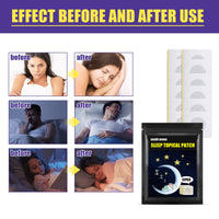 South Moon Sleep Patch Home Gentle Care To Improve Sleep Quality Daily Body Care Patch