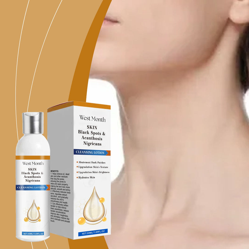 Acanthoderm Cleansing Lotion, Soft Moisturizing Moisturizing Refreshing Elbow And Neck Care Lotion