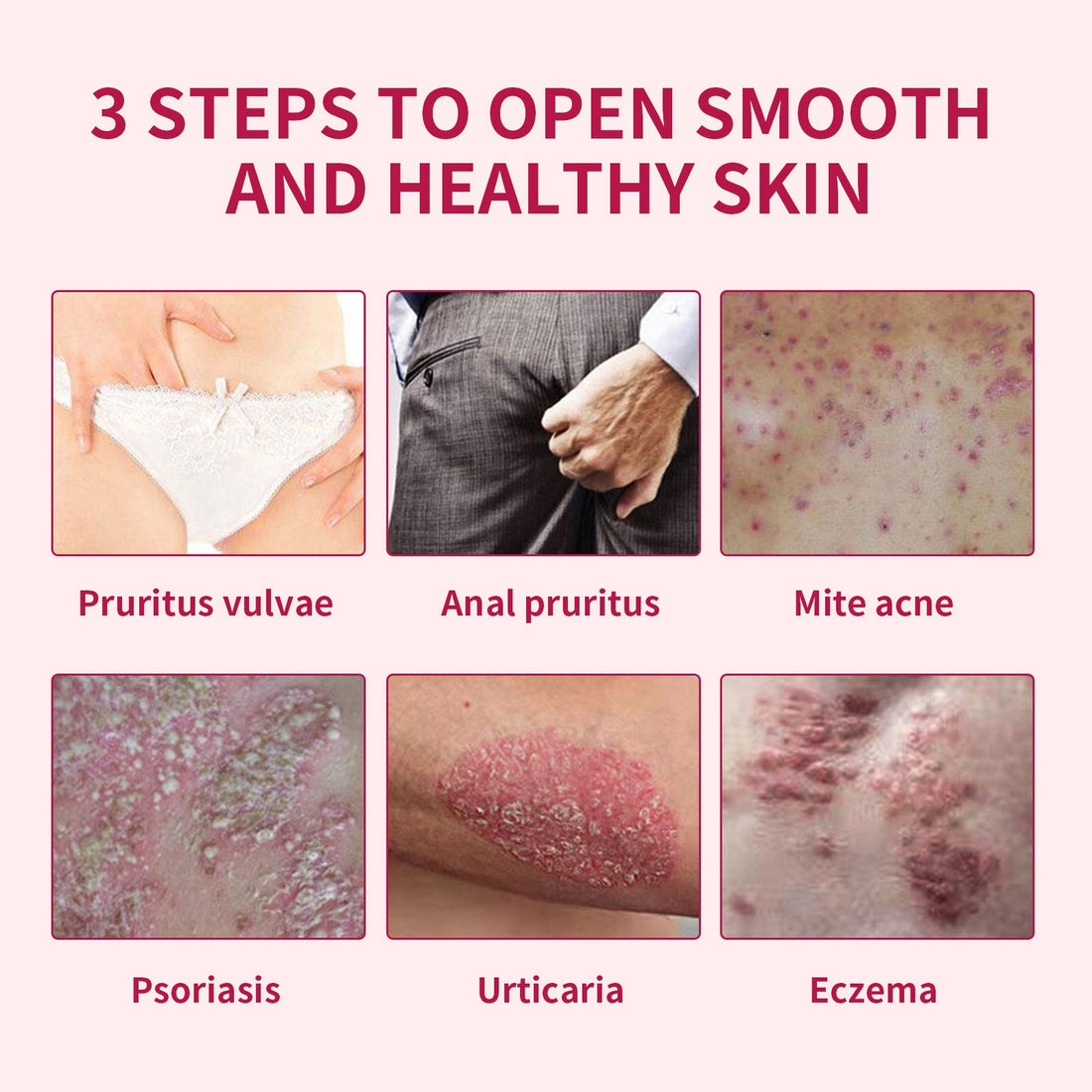 Wormwood Anti-Itch Body Wash, Refreshing, Repairing, Lubricating, Cleansing, Moisturizing And Cleansing Skin