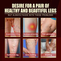 Vein Repair Agent Varicose Massage Relieves Earthworm Leg Repair Soreness And Swelling Body Care