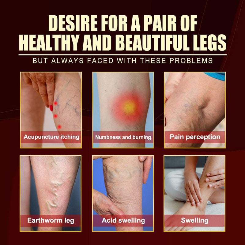 Vein Repair Agent Varicose Massage Relieves Earthworm Leg Repair Soreness And Swelling Body Care
