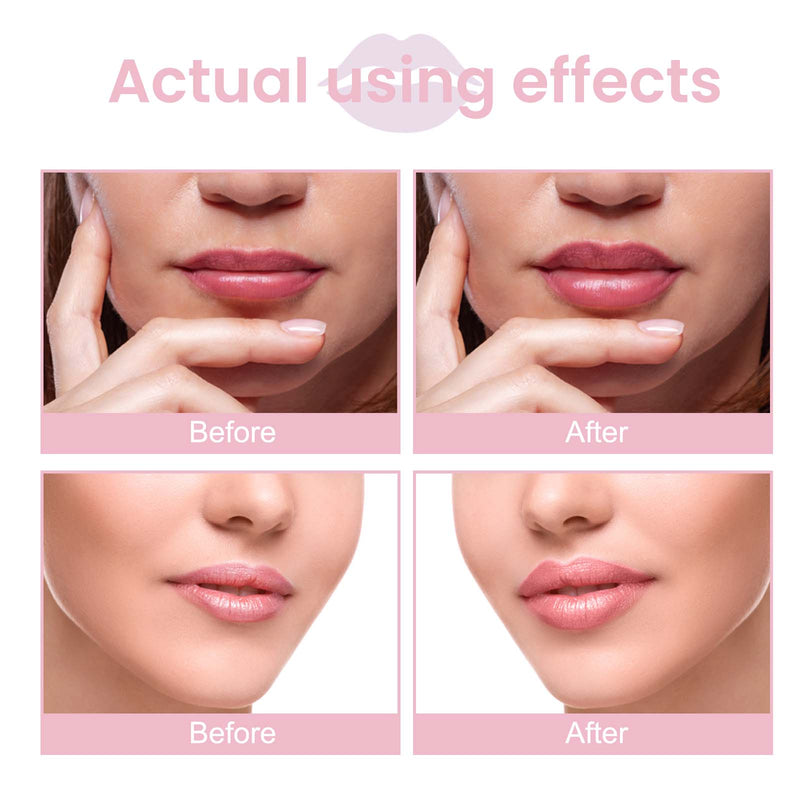 Lip Plumping Serum Plump And Moisturize Lips And Reduce Lip Lines, Dry And Dead Skin, Plump And Plump Lips