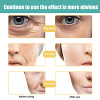 Skin Care Cream, Anti-Aging Skin Repair Cream Hydrates, Reduces Fine Lines, Firming And Brightening