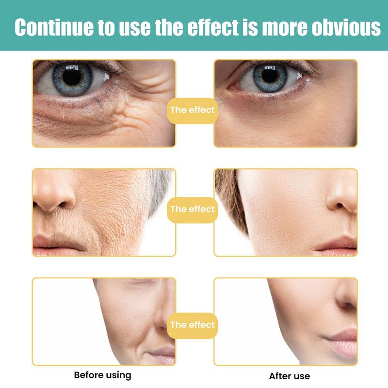 Skin Care Cream, Anti-Aging Skin Repair Cream Hydrates, Reduces Fine Lines, Firming And Brightening