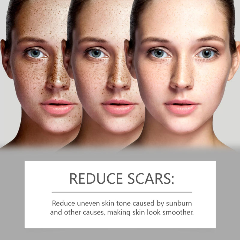 West&Month Skin Repair Serum Gently Moisturizes Facial Skin, Improves Dull And Brightening Skin Care Essence