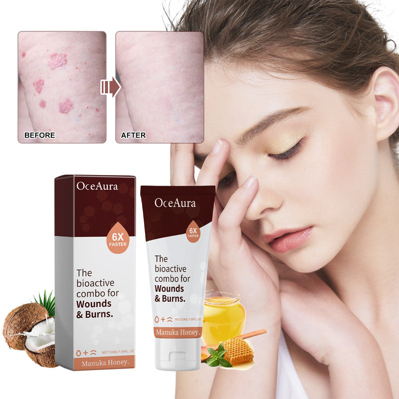 The Bioactive Combo For Wounds& Burns, Alleviate The Brotherhood Of Itchy Skin Redness Itching Repair Body Care Cream