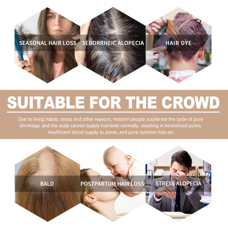 Hair Boost Essence, Improve Dry Short-Tempered Prevent Hair Nourishing Strength Repair Hair Root Hair, Protect Hair Oil