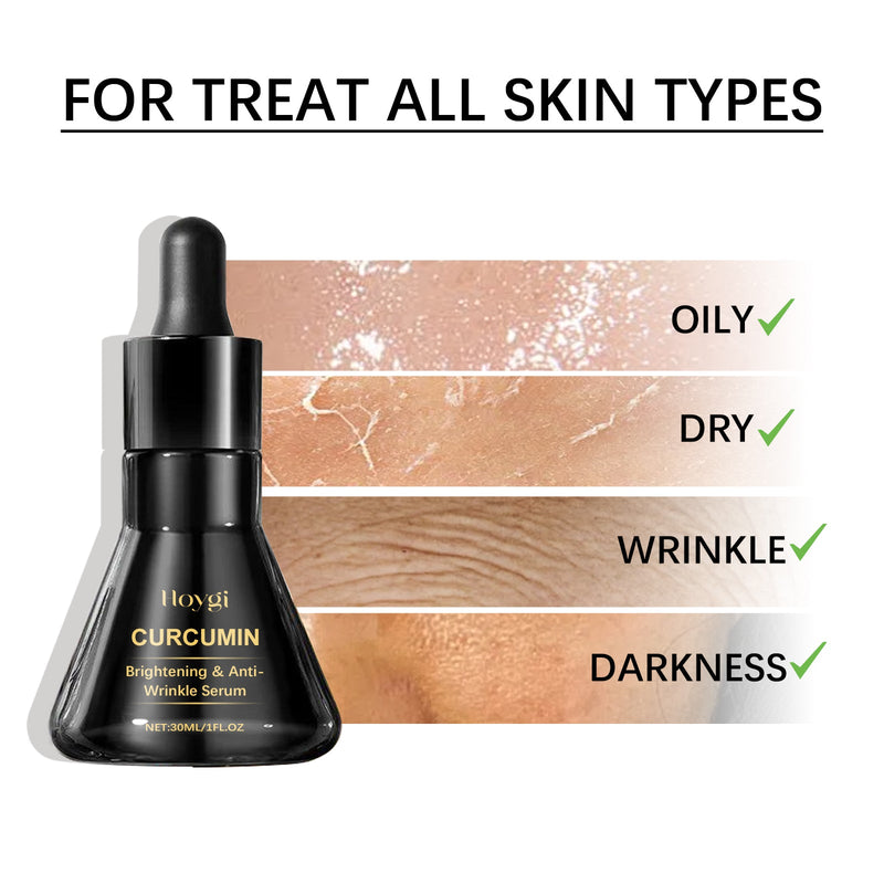 Hoygi Brightening Anti-Wrinkle Serum - Reduces Dark Spots, Firms & Hydrates