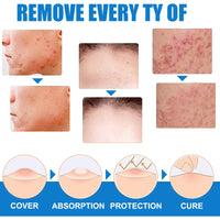 Warts Cream, Repair Skin Granules Gram Wart Body Care Topical Cream