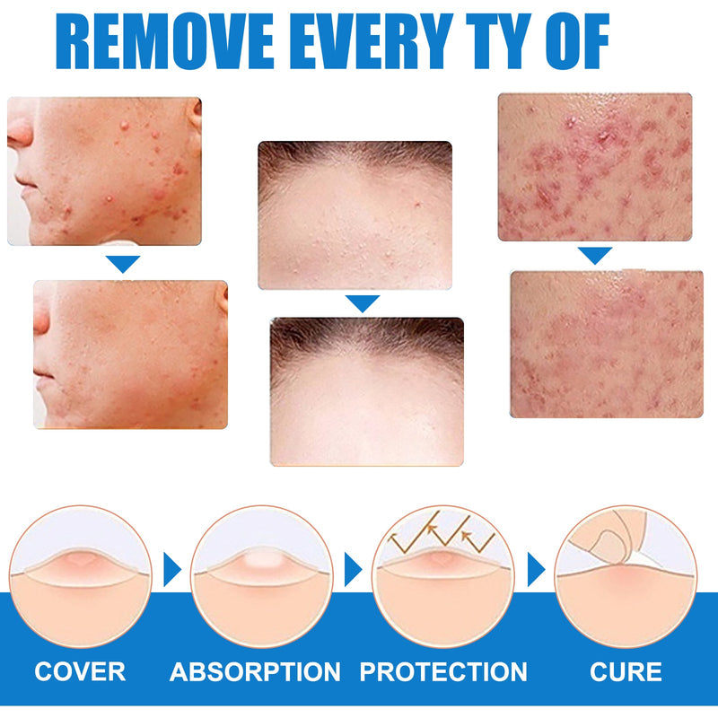 Warts Cream, Repair Skin Granules Gram Wart Body Care Topical Cream