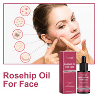 Rosehip Oil For Face, Delicate Pores Smooth Repair Facial Moisturizing Fade Acne Blackheads