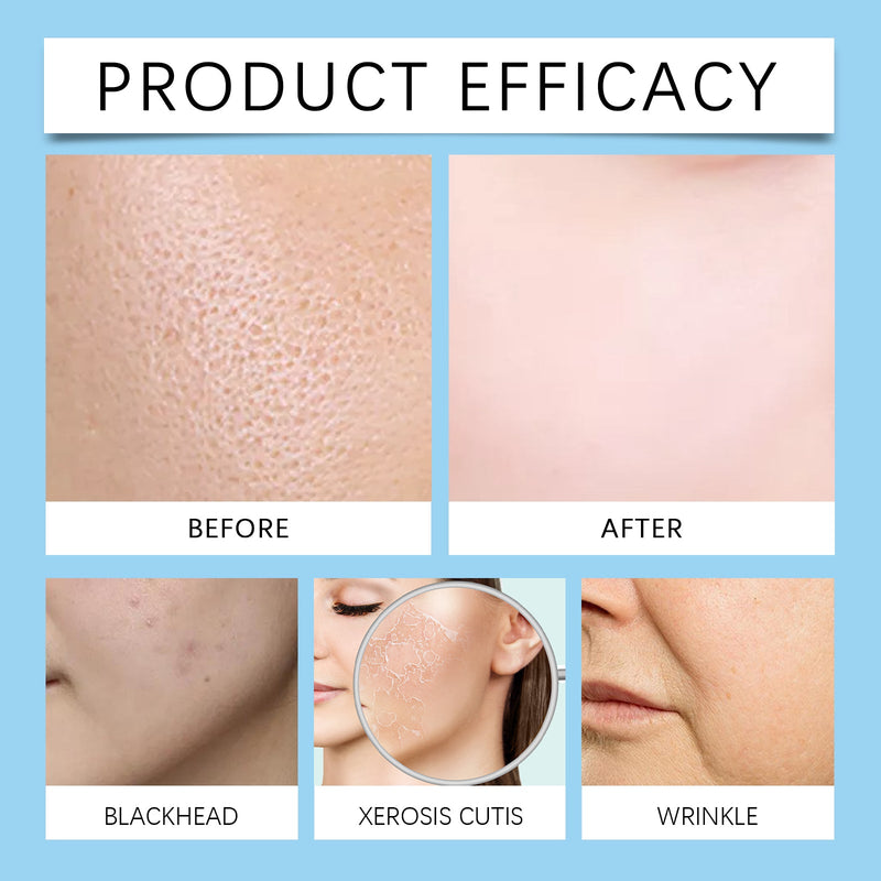 JAYSUING Hyaluronic Acid Stock Solution - Improves Pores, Hydrating Facial Luster