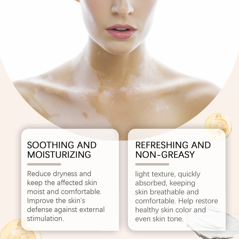 Body Care Cream, Relieve Itching And Swelling Of Hands And Feet Skin Moisturizing Skin Care Cream