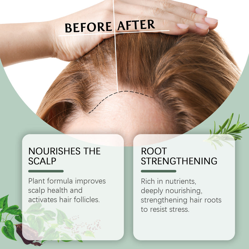 Original Rosemary Hair Spray, Rosemary Dense Hair Nourishing Scalp Massage Jet Black Growth Spray