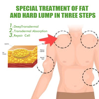 OUHOE Fat Binding Cream, Dredge Body Of Many Kinds Of Fat Caking Tumor Subcutaneous Lumps Body Care Cream