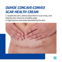 Ouhoe Scar Repair Cream, Gentle Repair Smooth Skin Fade After Scar Scar Skin Repair Cream