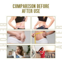 Bee-Poison Nasal Soothing Cream Moisturizes And Shows Off Your Figure Light And Firming Skin Body Care Cream