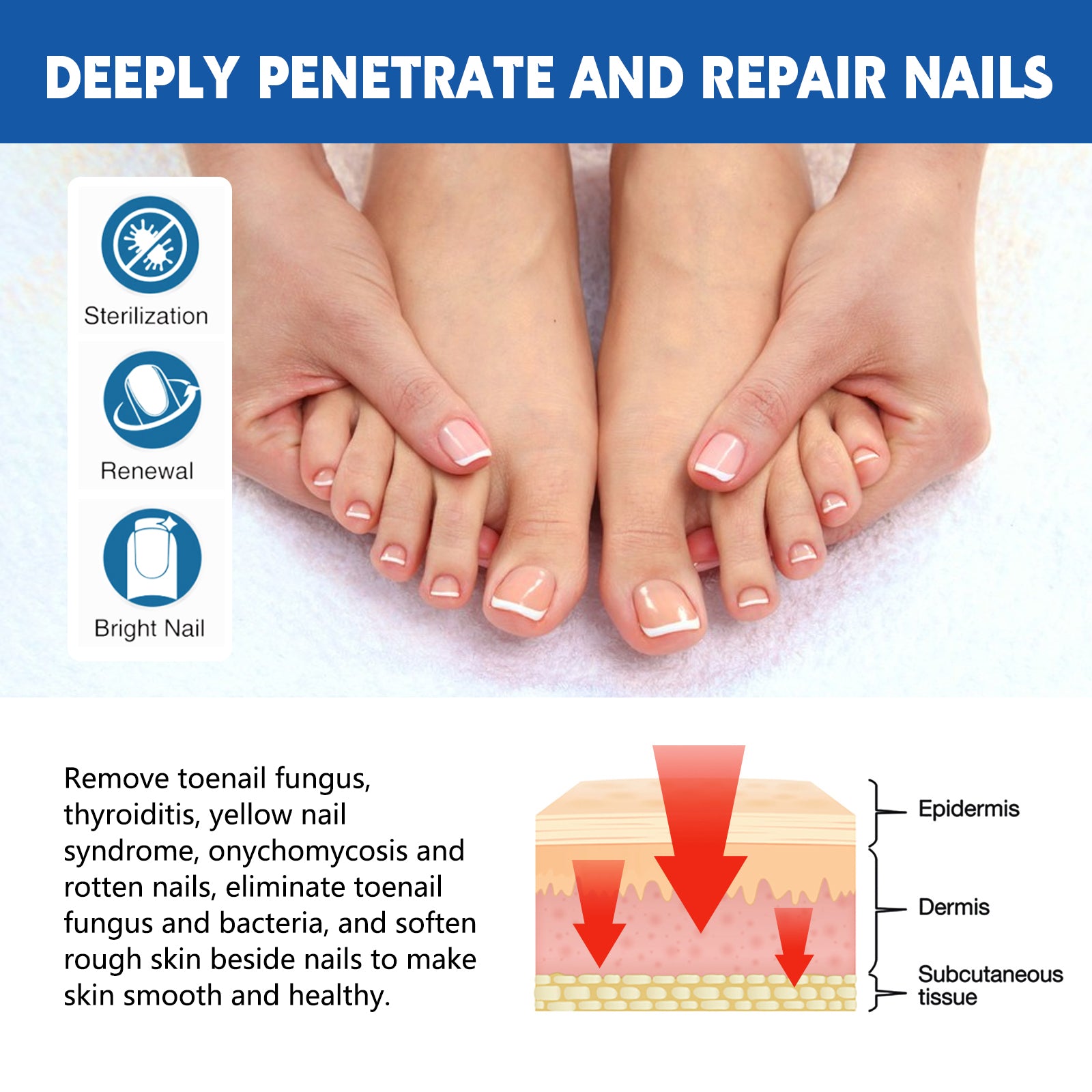 Nail Seam Care Patch, Repair Thickening Gray Nail Soft Nail Correction Nail Seam Patch