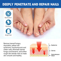 Nail Seam Care Patch, Repair Thickening Gray Nail Soft Nail Correction Nail Seam Patch