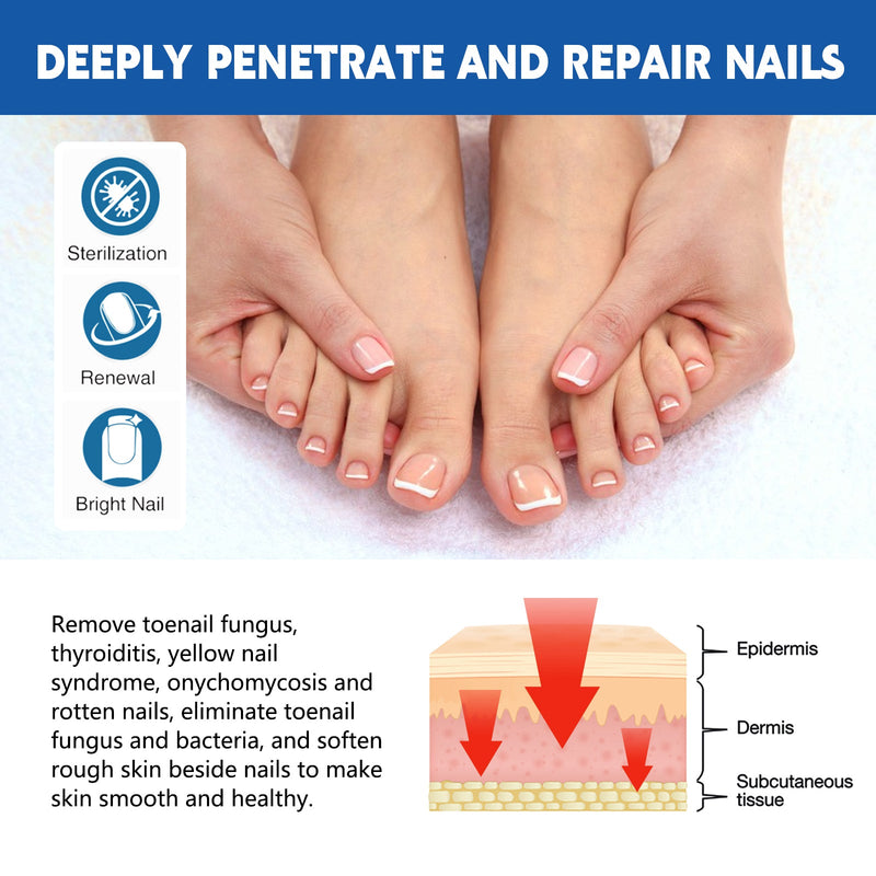 Nail Seam Care Patch, Repair Thickening Gray Nail Soft Nail Correction Nail Seam Patch