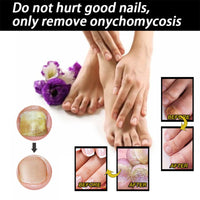 EELHOE Nail Repair Solution Thickening Brightening Nails Removing Gray Nails Dead Skin Repair Nourishing Nail Care Solution