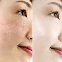 VIBRANT GLAMOUR Hyaluronic Acid Face Serum Anti-Aging Shrink Pore Whitening Moisturizing Essence Face Cream Dry Skin Care 15ml