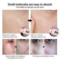 LANBENA Hyaluronic Acid Serum Blackhead Removing Moisturizing Acne Treatment Skin Care Repair Whitening Anti-Aging Winkles 15ml