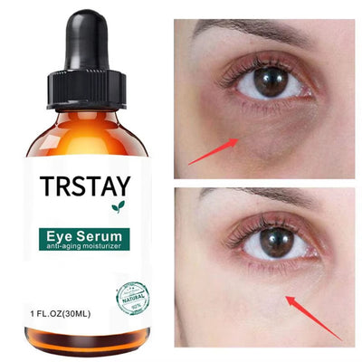 10Ml