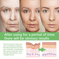 Face Serum Hyaluronic Acid Essence Moisturizing Nursing Snail Nourish Repair Skin Care Korean Beauty Health Whitening Cream