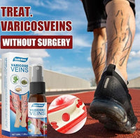 South Moon - Varicose Veins