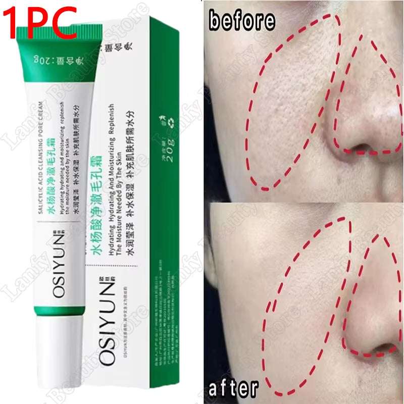 Salicylic Acid Pore Clearing Cream Shrink Pores Remove Blackheads Acne Brighten Moisturizing Smooth Skin Care Korean Products